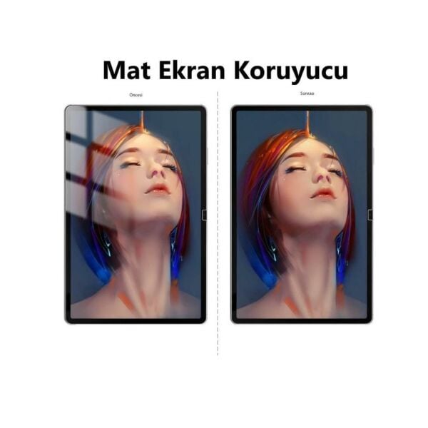 Honor Pad X8a 11 inç Mat Ekran Koruyucu Parlamayı Önler