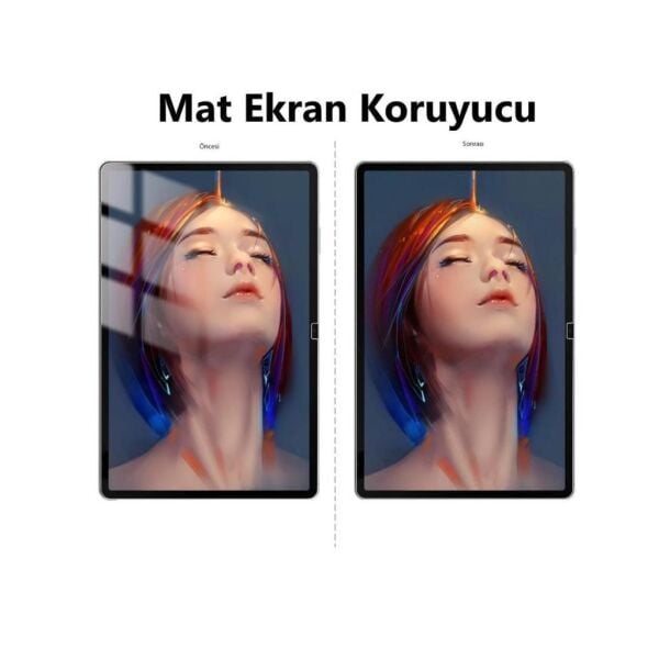 Samsung Galaxy Tab S11 Mat Ekran Koruyucu 11 inç SM-X730